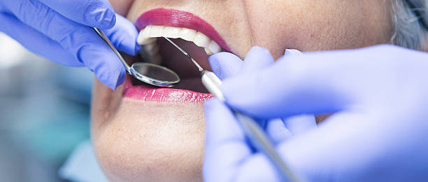 Best Emergency Root Canal Treatment in Eunice, LA